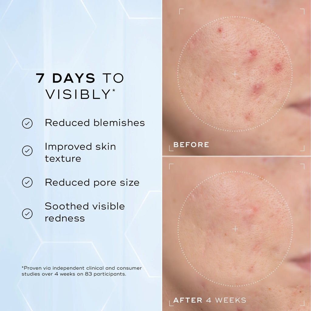 Niacinamide Peptides
